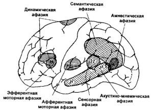 vidi-afaisij-300x216