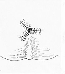 001-4