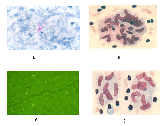 http://www.dntpasteur.ru/images/manual2_1.gif