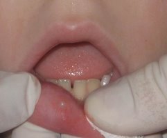IMG_2277