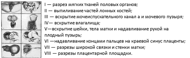Техника секционного исследования женских половых органов