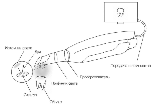 Схематическое изображение принципа работы внутриротового сканера [3]