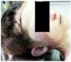 , 2, 3, 4. Повреждения, обнаруженные при исследовании трупа девочки