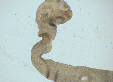 Сколекс Mesocestoides spp