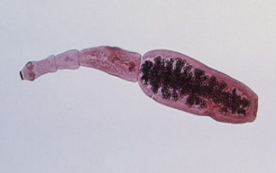 Половозрелая стадия Echinococcus Granulosus