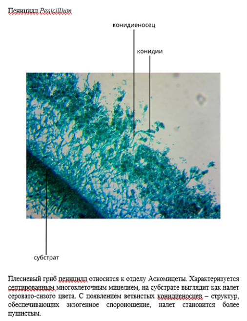 Вариант оформления электронного атласа микропрепарата пеницилл Penicillium