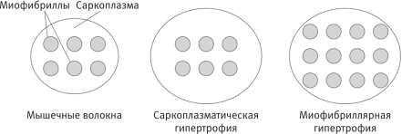 Типы мышечной гипертрофии [1]