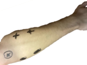 Схема наложения электродов