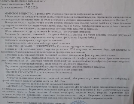 Заключение МРТ головного мозга от 17.12.2022