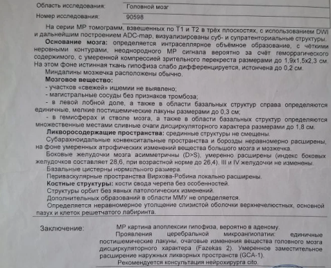 Заключение МРТ головного мозга от 25.04.2025
