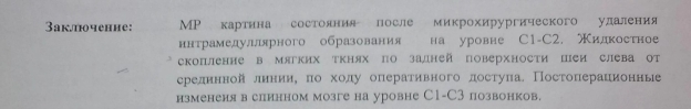 Заключение МРТ шейного отдела от 22.06.2023