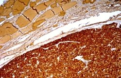 calcitonin.jpg