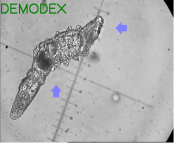 DEMODEX
