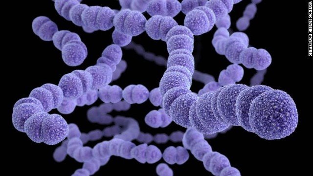 http://www.nazdor.ru/images/articles/streptococcus-pneumoniae.jpg
