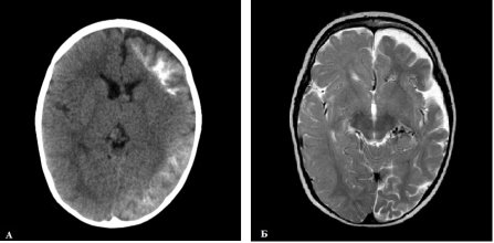 http://neuro-online.ru/images/gsdmj.jpg