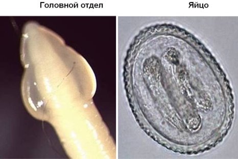 http://yachist.ru/wp-content/uploads/2017/08/Toksokara-foto.jpg