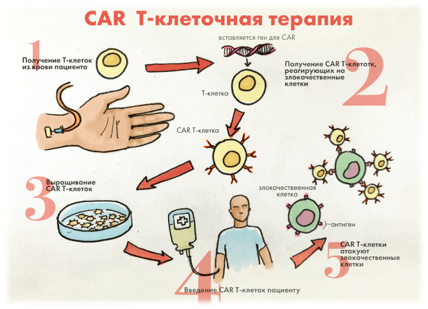 https://biomolecula.ru/img/content/2873/2873-04.CAR-T.png