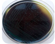 Рост Listeria monocytogenes в среде Oxford