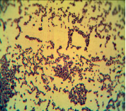 L. monocytogenes суточная бульонная культура ×1000