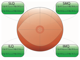 DIEP flap pressure thresholds at 12 months postopera-tively. SLQ, superior lateral quadrant; SMQ, superior medial quad- rant; ILQ, inferior lateral quadrant; IMQ, inferior medial quadrant; 1-Sp, one-point static discrimination; 1-Mp, one-point moving discrimination; 2-Sp, two-point static discrimination; 2-Mp, two- point moving discrimination