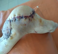 Контрольный осмотр на 9 сутки