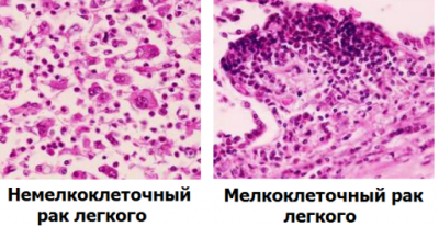 Примеры НМКРЛ и МКР
