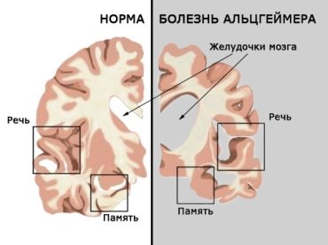 https://gif.cmtt.space/3/club/34/b6/75/93804c4d8a01b1.jpg