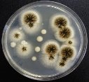 http://iws.collin.edu/mweis/microbiology/lab/lab%20exercises/media_selective_differential/photos_media_selective_diff/micro_SAB_fungi_yeast.jpg
