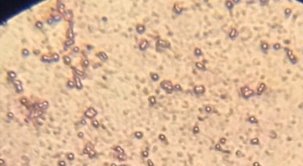 Колонии бактерий открытого грунта (1- поверхность, 2 — глубина 20 см.) (Ул. Южная).