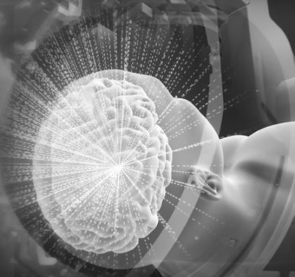 Схематическое воздействие ультразвуковых волн на участок мозга, вызывающий дрожание руки (тремор)