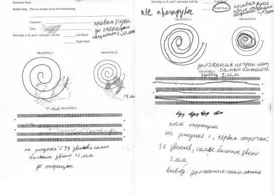 Спирали пациента