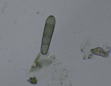 Конидии патогена Pyrenophora teres (оригинал, 2020 г.)