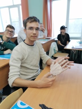 Конечный результат сборки бионического протеза