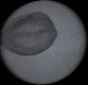 Ренгенограммы грецкого ореха с ядром (слева) и без ядра (справа)