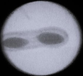 Рентгенограмма плодов арахиса