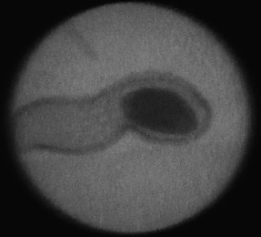 Рентгенограмма плодов арахиса