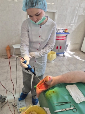 Обработка трофической язвы водным раствором повидон-йода