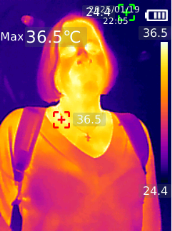 Термограмма здорового человека