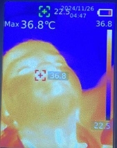 Тепловизор указывает на источник боли малыша