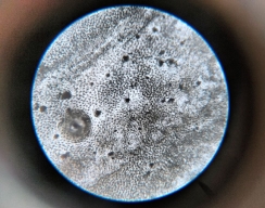 хитин палочника под микроскопом