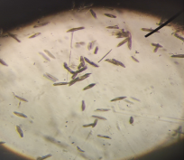 Культура инфузорий в контрольной пробе воды