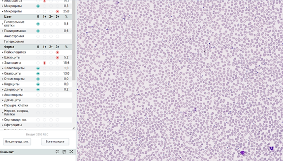 Мазок крови человека в изображении лабораторной информационной системы