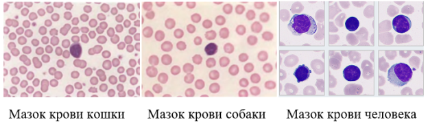 Визуальное сравнение лейкоцитов