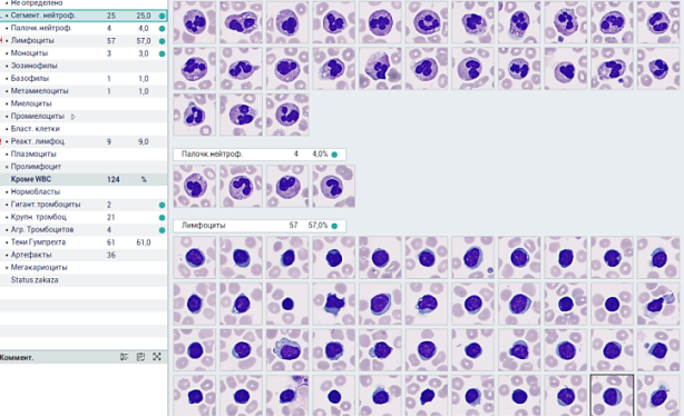 Лейкоциты человека в изображении лабораторной информационной системы