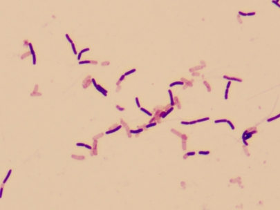 Фотография Bacillus subtilis под микроскопом, увеличение 1000 х.